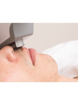 顔脱毛がしたい