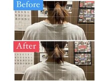 ナオル整体 宮崎院(NAORU整体)/30代女性施術事例【肩の膨隆差】