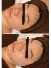 ジェニー(JENNI)/TROIAREUKEスキンメイド