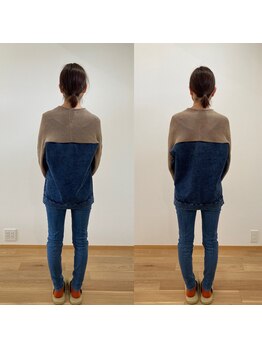 ランドル(rendre)/５０代女性　脊柱弯曲と腰痛