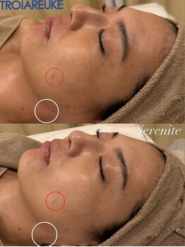 セレニテ(Serenite)/