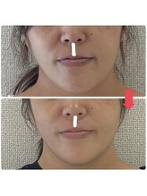 ラボーテヴェリテ(La Beaute Verite)/【お客様施術例】