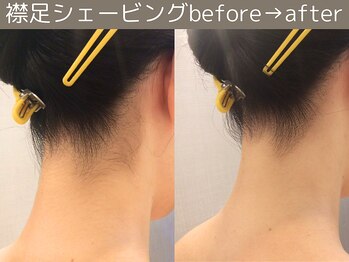 ももとゆでたまご/襟足シェービングbefore→after