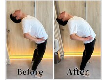 整体ラルース 中目黒(LALUZ)/30代　男性　腰痛、姿勢改善