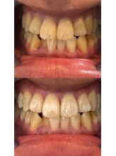 アレッド 大阪店(ared.)/自信を持てる歯に！