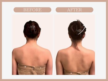 スリムライン 弘前店(The Slim Line)/before→after