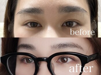 シエナ アイ(CIENA eye)/