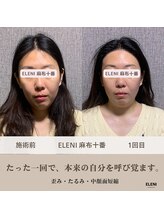 エレーニ 麻布十番(ELENI)/フェイスラインが整った