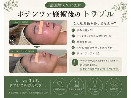 ピオニー(peony)の写真