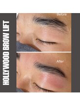 セラス(CERAS)/ハリウッドブロウリフト