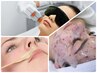 【FACEWAX+光脱毛】フェイスダブル脱毛&ハイドロジェリーマスク☆13,200円