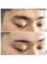 ホワイト(WHITE)/□Before→After