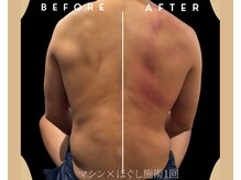 モミ(MOMI)の雰囲気（他店で満足できない方にオススメ♪マシン×ほぐしでこり改善！）