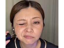 ハピネス(Happiness)の雰囲気（新メニューテラボーラー！ギュッと筋肉を収縮させ変顔から小顔へ）