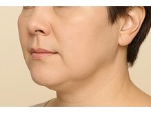 メディケア 新宿/元祖小顔トレーニング