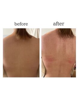 ピュア(pure)/ハーブテント３回の効果*