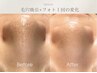 【毛穴改善】毛穴洗浄引締めプレミアム美肌フェイシャルコース極上仕上げ