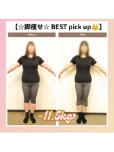 えのもと美容整体院/【脚引き締め　BEST pick up】