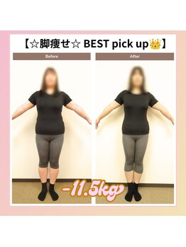 えのもと美容整体院/【脚引き締め BEST pick up】