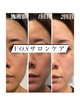 ビューティー アディクト(Beauty addict)/劇的変化が望めるVOSサロンケア