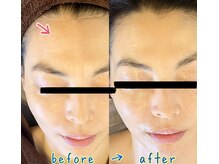 クレール(Claire)/シワ改善！たるみ改善！