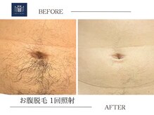 メンズメイド(Mens'Made)/before/after