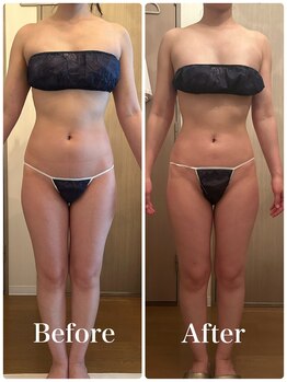 パルフェット(parfaite)/ウエストくびれが欲しい方