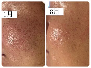 サロン ド エメ(salon de aimer)/本気の肌改善お任せください!!