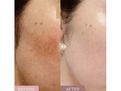 フルリールの写真