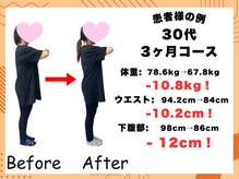 整体院ニコット/30代　3ヶ月ダイエット成果