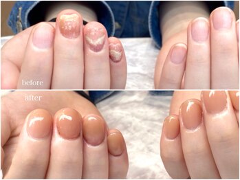 深爪矯正で美爪育成☆