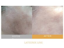 ベルーナビューティ 西新宿(Beluna beauty)/ラテニックス管理 