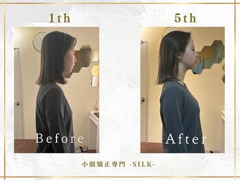 シルク(SILK)の写真/◆変わるのは、ちゃんと理由がある◆SILKでは、小顔矯正だけでは終わらない。身体全体からもアプローチ◎