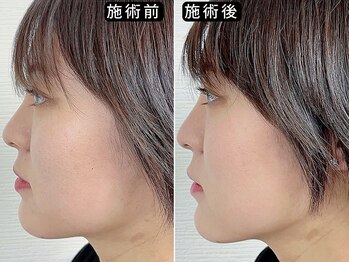 アオヤマ サロン ワイゼット(AOYAMA SALON YZ)/自信がもてるフェイスラインへ