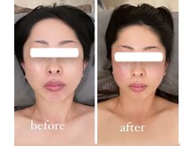 ジーニー(Genie)/「変化」をすぐに確認