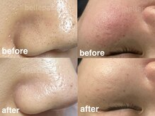 ベルパス(bellepas)の雰囲気（お肌や毛穴の悩みに合わせてメニューをご用意いたします。）