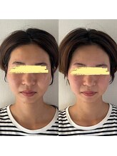 美健家/before⇒after