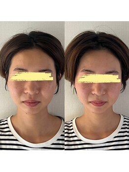 美健家/before⇒after