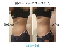 リープル(Leapl)/【痩身】初回でもこの変化!