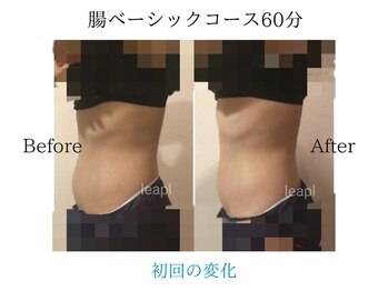 リープル(Leapl)/【痩身】初回でもこの変化!