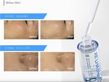 ドロップ 天王寺(DROP)/セラピール【韓国ピーリング】