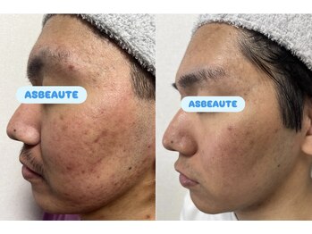 アスポーテ(ASBEAUTE)/メンズエステ