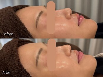 アウラ 小杉店(AULA)/ララピール☆