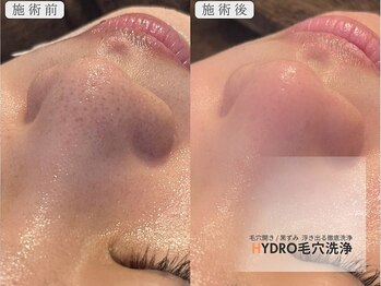 アンノウン(Unknown.)