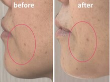 サロン ド ラン(Salon.du.RAN)の雰囲気（リフトアップケアで気になる口角の下がりもケア◎下がり肌予防）