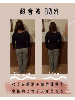 マノン(Manon)の写真/【人気ＮＯ．１】全身のコリむくみ疲れをケア！サイズダウンとお顔のたるみ改善リフトアップで輝く私へ◎