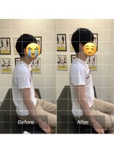 ナオル整体 三宮院(NAORU整体)/20代男性整体事例【猫背】