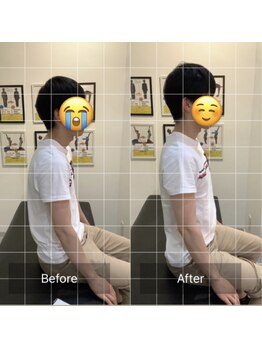 ナオル整体 三宮院(NAORU整体)/20代男性整体事例【猫背】