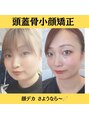 グレースフィオーレ モラージュ柏店(gracefiore) 私自身お顔のコンプレックスから脱出！！何なりとご相談下さい