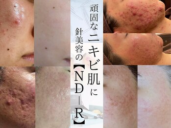 ラシュレ(BEAUTY CONCIERGE RASSURER)